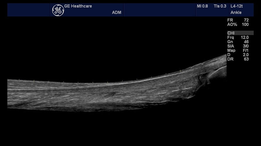 NextGen LOGIQ E R8 Compact Ultrasound w/ 7-Year Clinic Support
