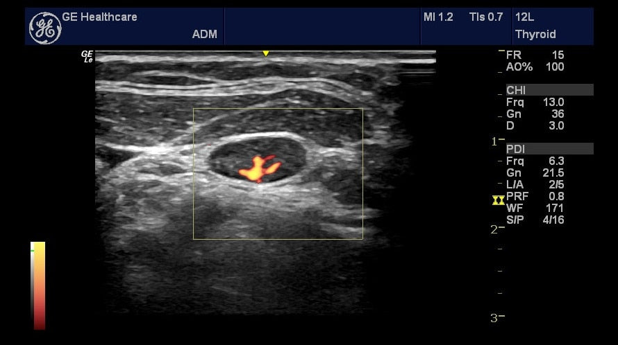 NextGen LOGIQ E R8 Compact Ultrasound w/ 7-Year Clinic Support