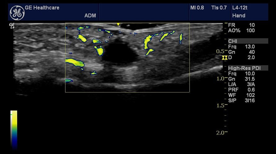 NextGen LOGIQ E R8 Compact Ultrasound w/ 7-Year Clinic Support