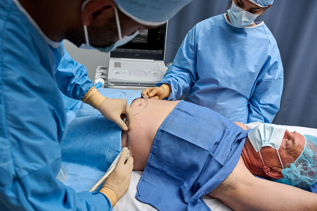 LOGIQ E Ultrasound