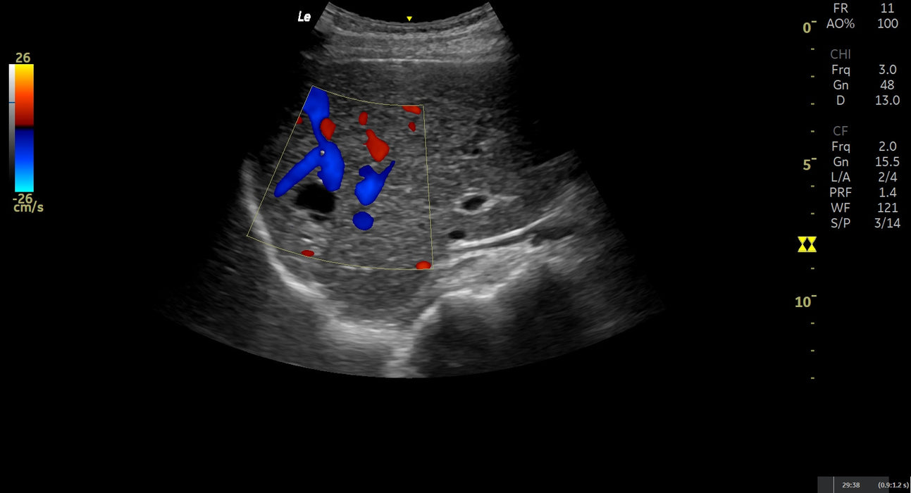 LOGIQ E Ultrasound