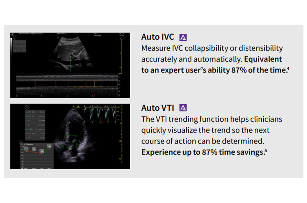 Venue Fit R5 Ultrasound