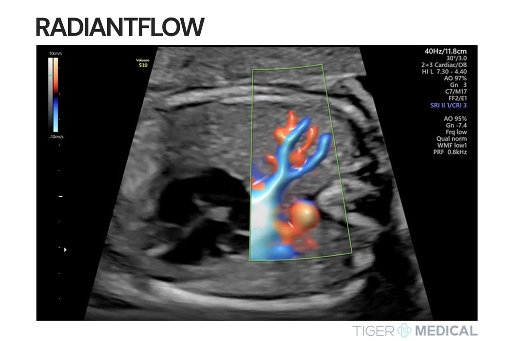 Voluson S8 Ultrasound w/ Touch Panel