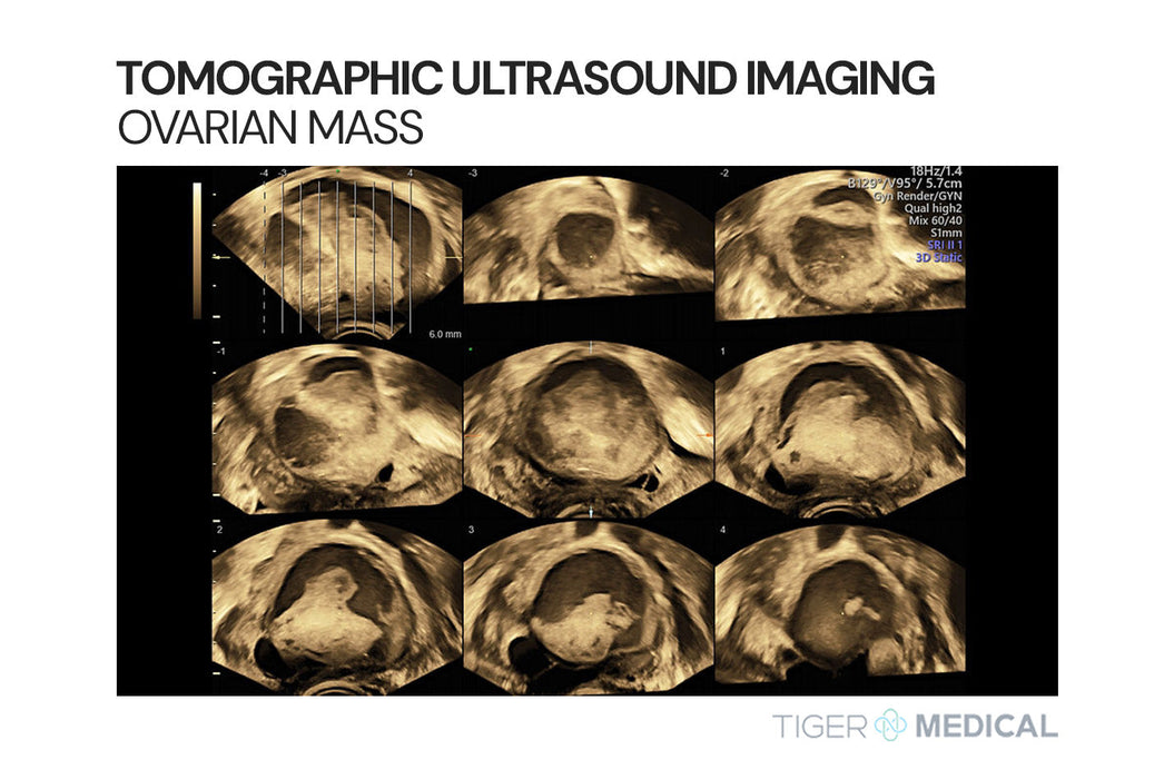 Voluson S8 Ultrasound w/ Touch Panel