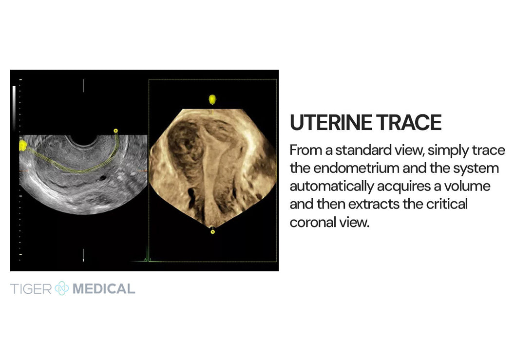 Voluson S8 Ultrasound w/ Touch Panel