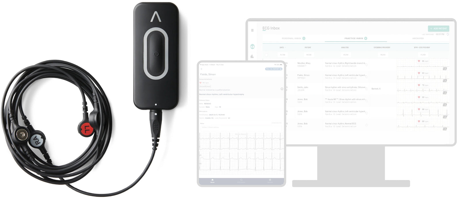 Kardia AI-Powered Handheld 12-Lead Resting ECG by Alivecor