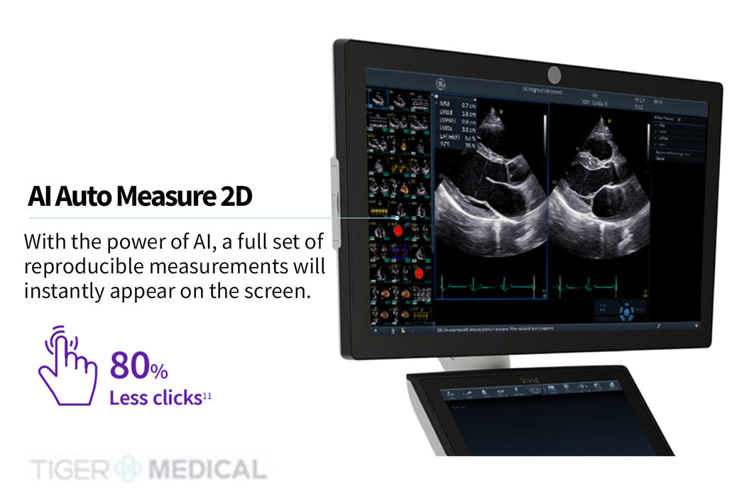 Vivid S70N Ultra Ultrasound System