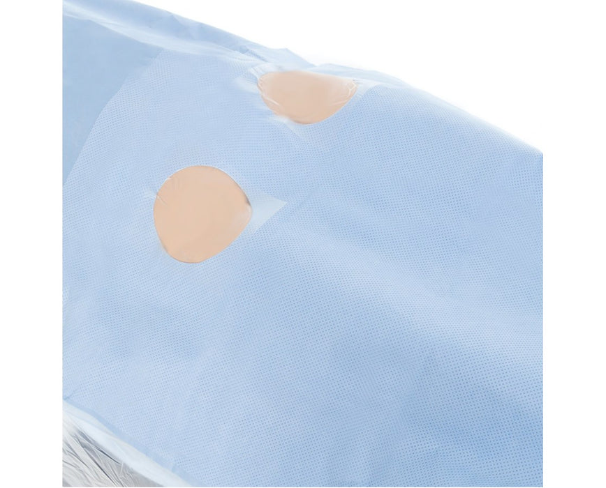 Femoral Angiography Drape with Windows, 87" x 124", Sterile - 18/cs