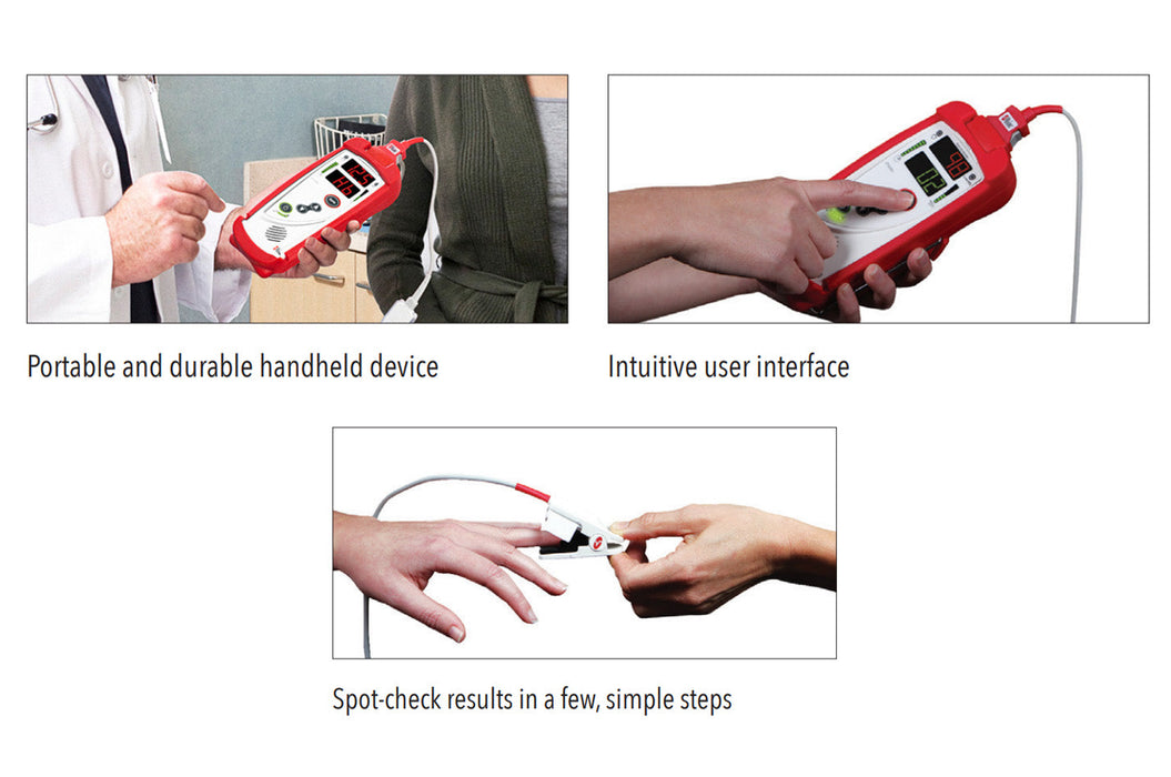 Pronto Pulse CO-Oximeter (PR, PI, SpHb)