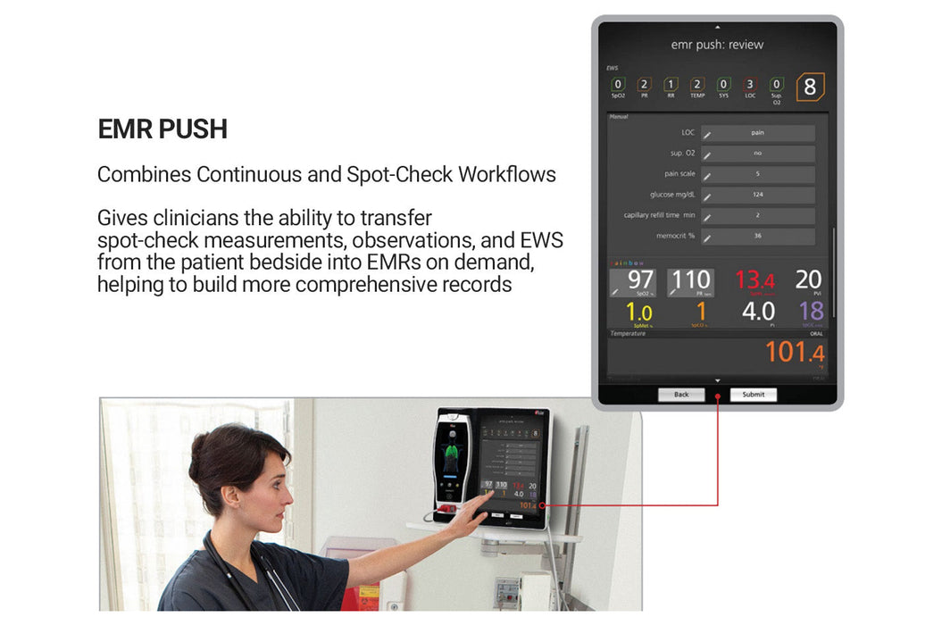 Root Touchscreen SpO2 Patient Monitor