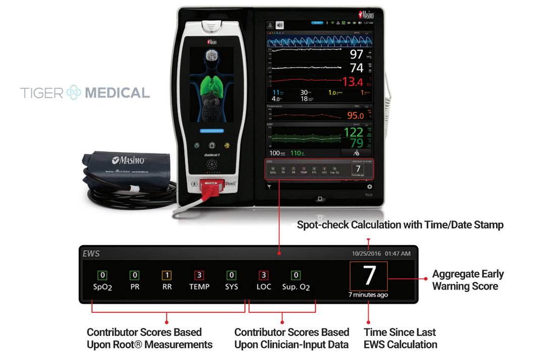 Root Touchscreen SpO2 Patient Monitor