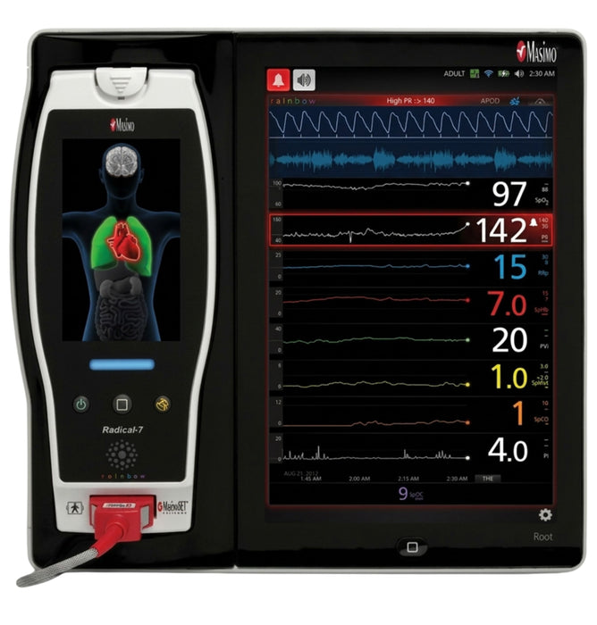 Root Touchscreen SpO2 Patient Monitor
