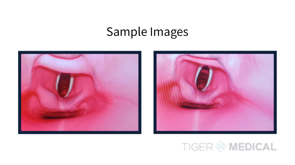 EZ Vision Video Laryngoscope