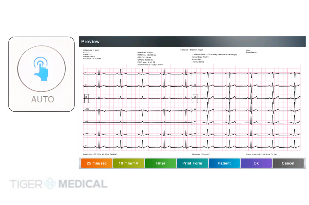 Q70 Guardian 12-Channel Resting ECG with Spirometry