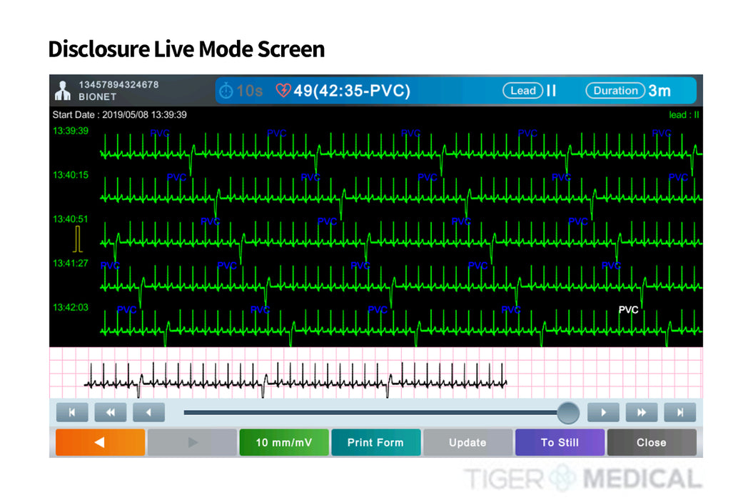 Q70 Guardian 12-Channel Resting ECG with Spirometry