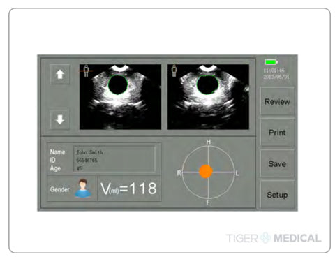 Caresono PadScan HD3 Bladder Scanner