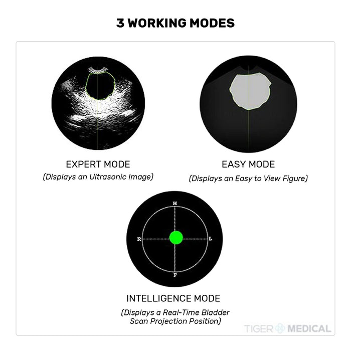 Peaksonic M2 Touchscreen 3D Bladder Scanner