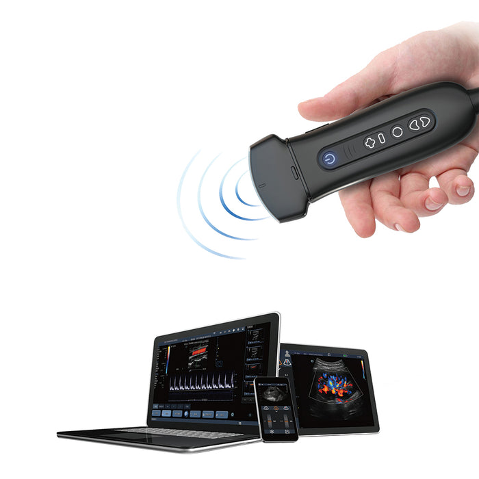 P50 Soloscan Handheld WiFi Ultrasound Scanner