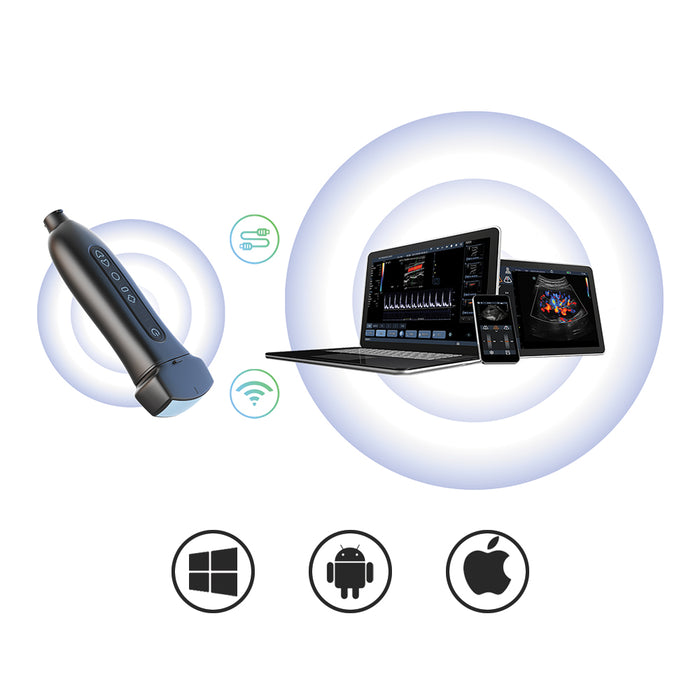 P50 Soloscan Handheld WiFi Ultrasound Scanner