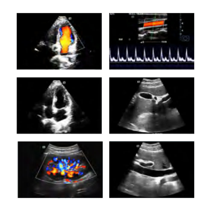 P50 Soloscan Handheld WiFi Ultrasound Scanner