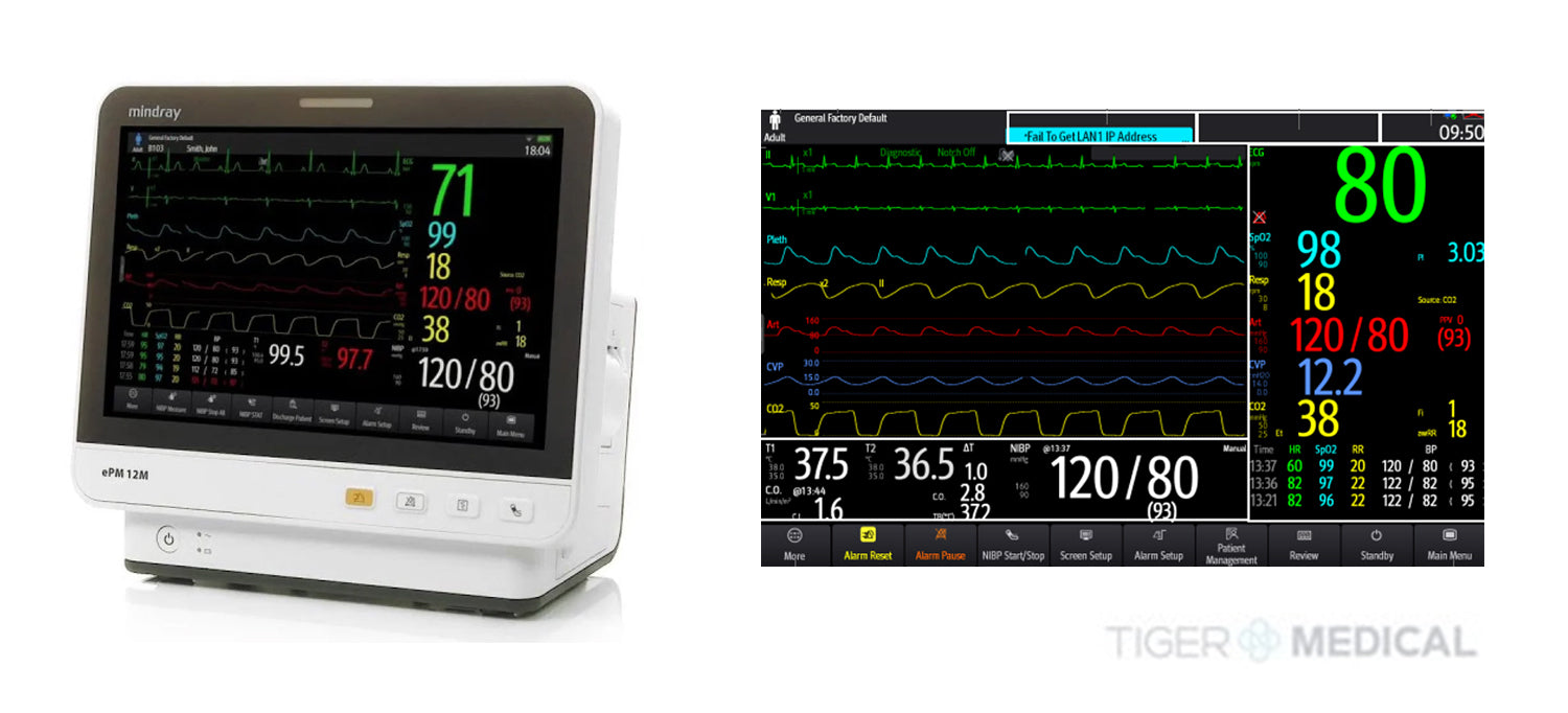 EPM 12M Vital Signs Monitor