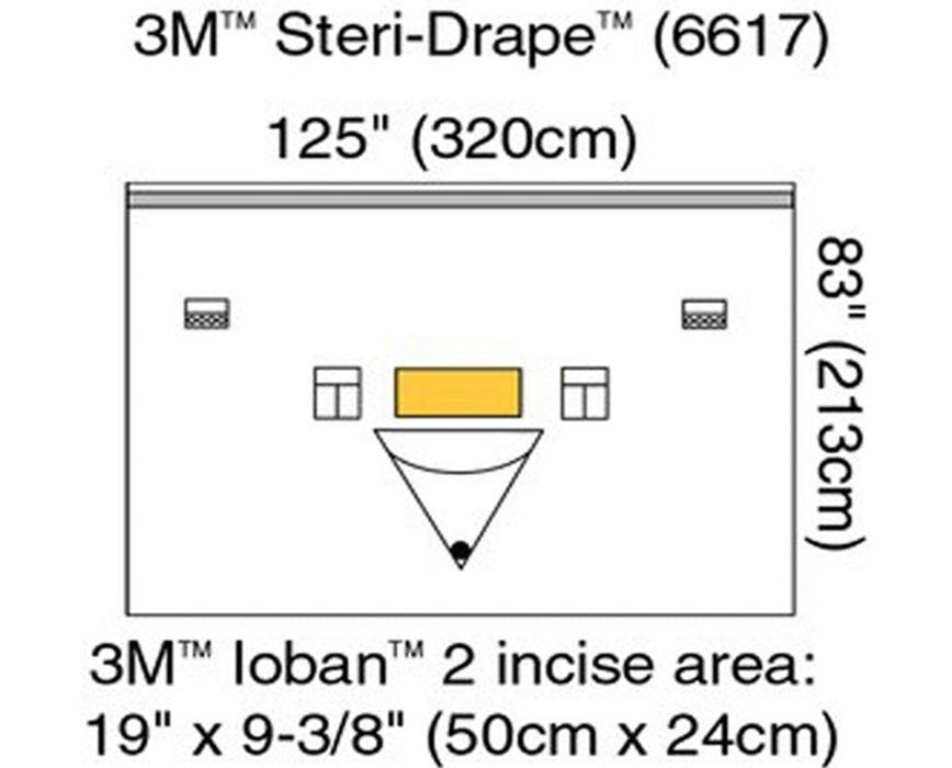 Steri-Drape Patient Isolation Drapes, Loban 2 Incise Film & Pouch, 126" x 83" - 20/Cs