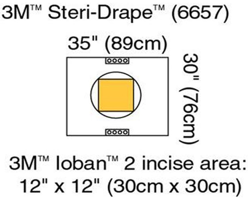 Steri-Drape C-Section Sheet w/ Ioban 2 Incise Pouch C-Section Pouch w/ Loban 2 Incise Film - 40/Cs