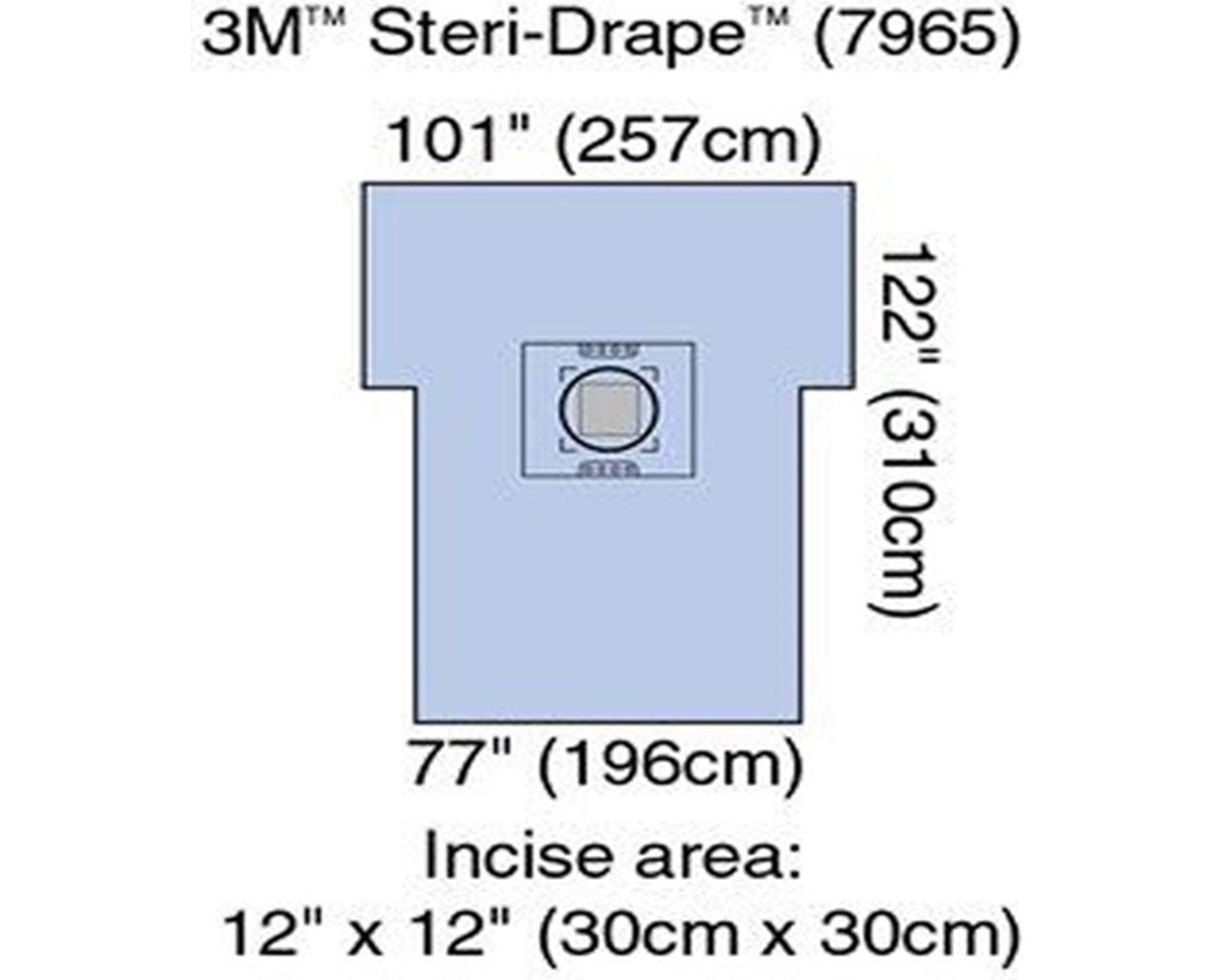 3M Steri-Drape C-Section Sheets – Save At — Tiger Medical