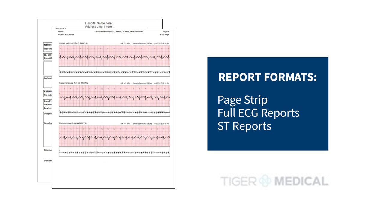 Burdick Vision Express Holter Analysis System