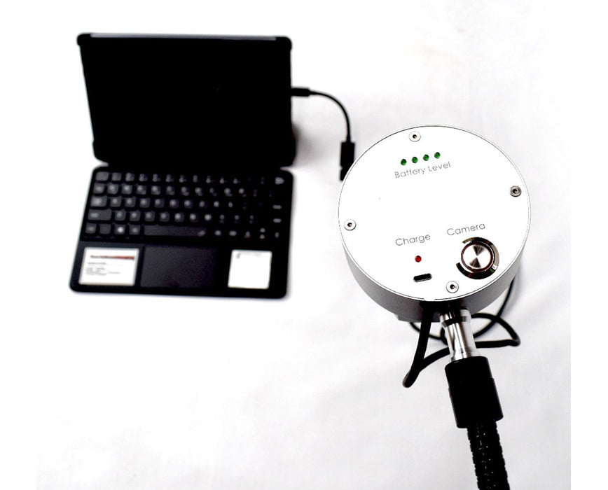 'Vein-Eye Carry' Vein Finder Camera