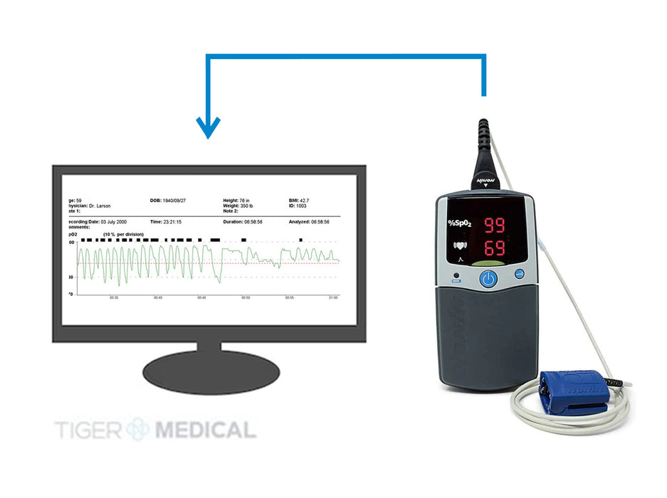 Palmsat 2500A Pulse Oximeter Monitor with Alarm