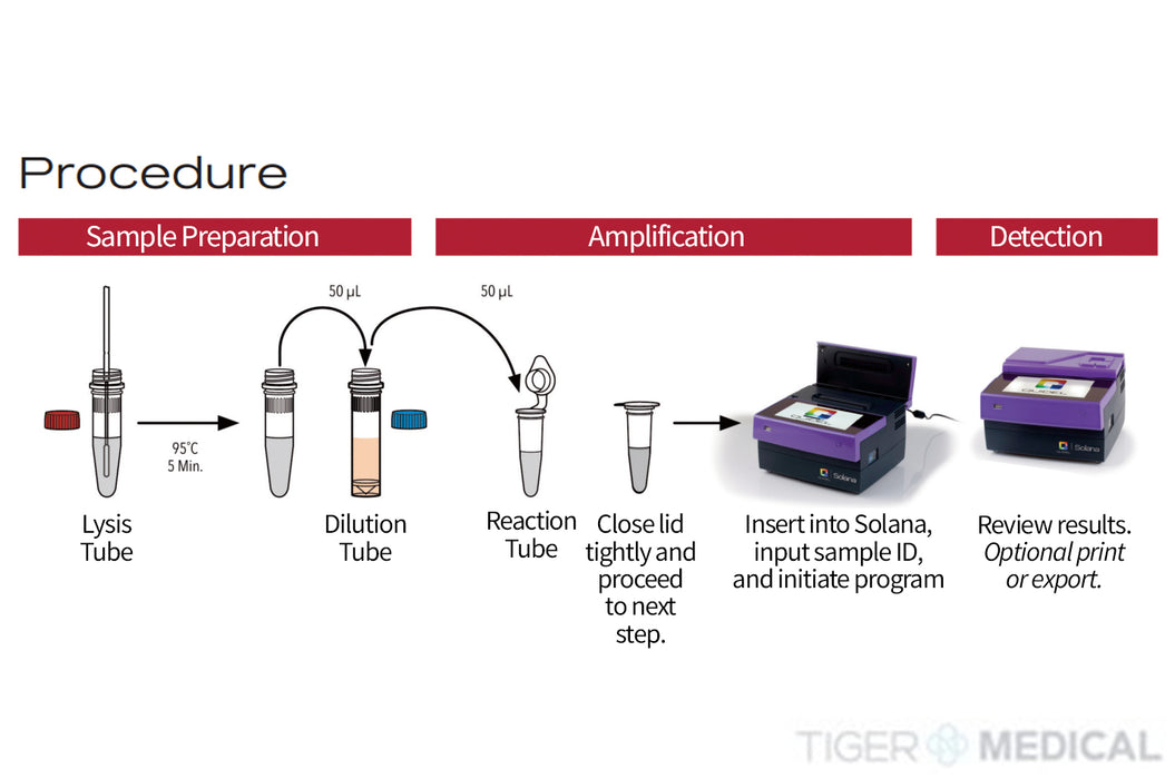 Solana GAS Molecular Assay Kit, 48 Tests per Kit