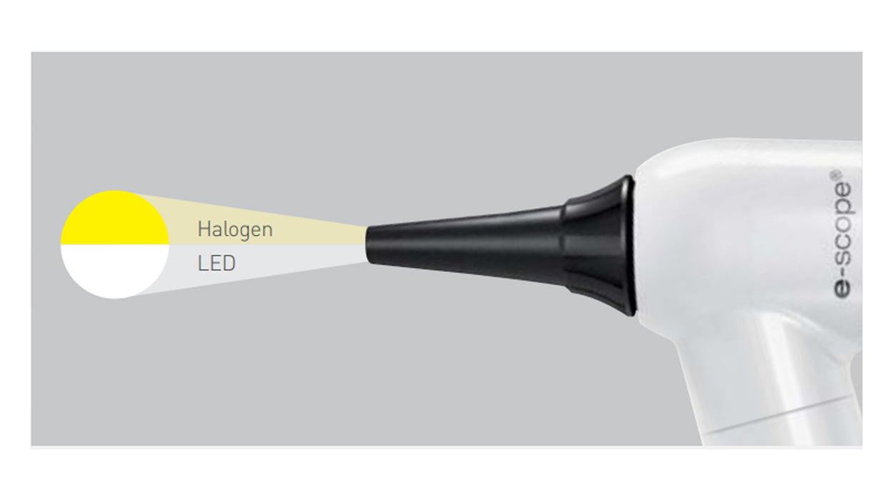 E-scope Ophthalmoscope