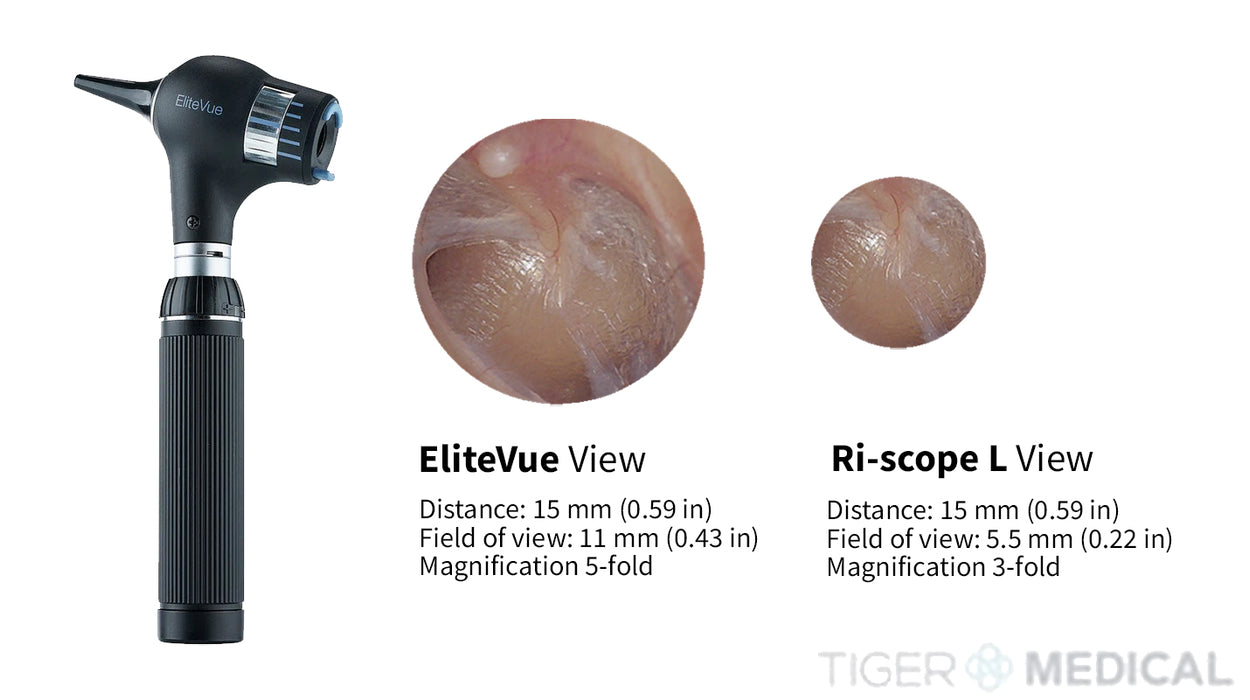 EliteVue Otoscope Set