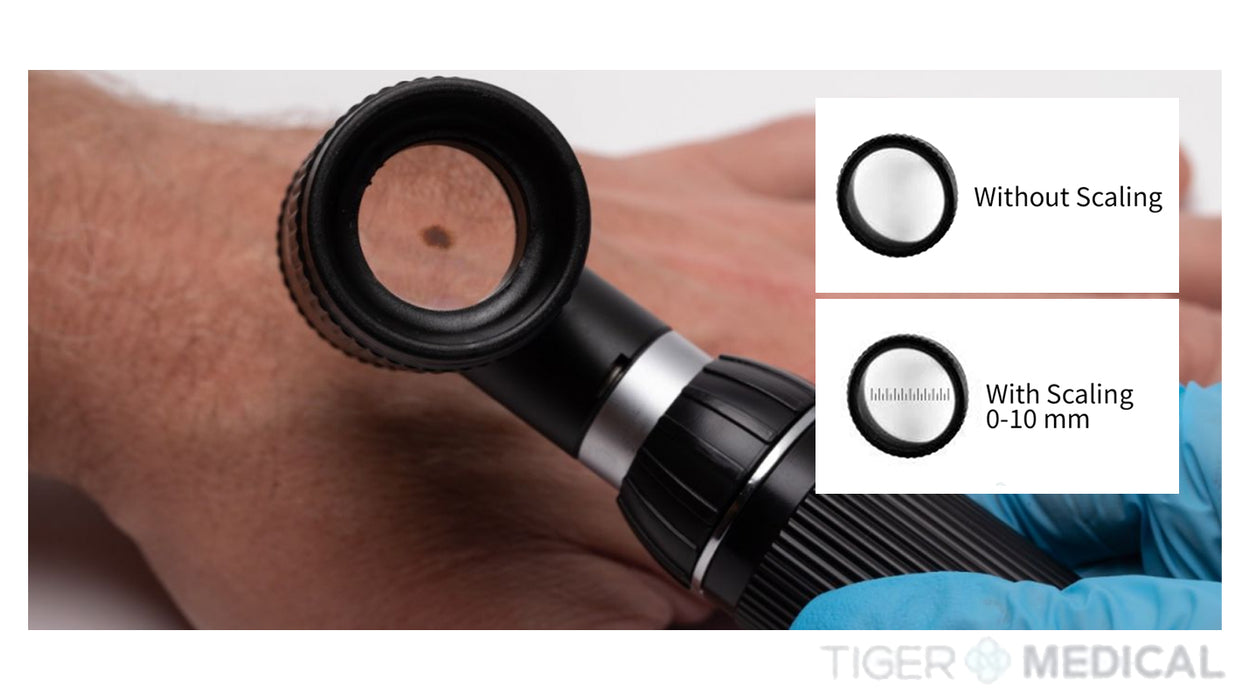 Ri-Derma Dermascope Dermatoscope, Plug-in Handle