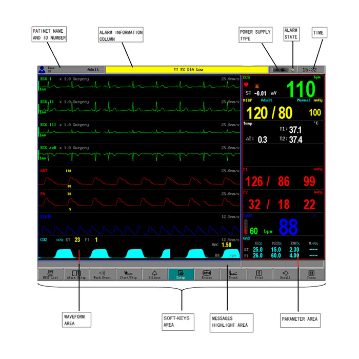 Tranquility II Multi-Parameter Patient Monitor