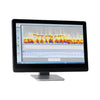 Medilog Darwin 2 Holter Analysis Software