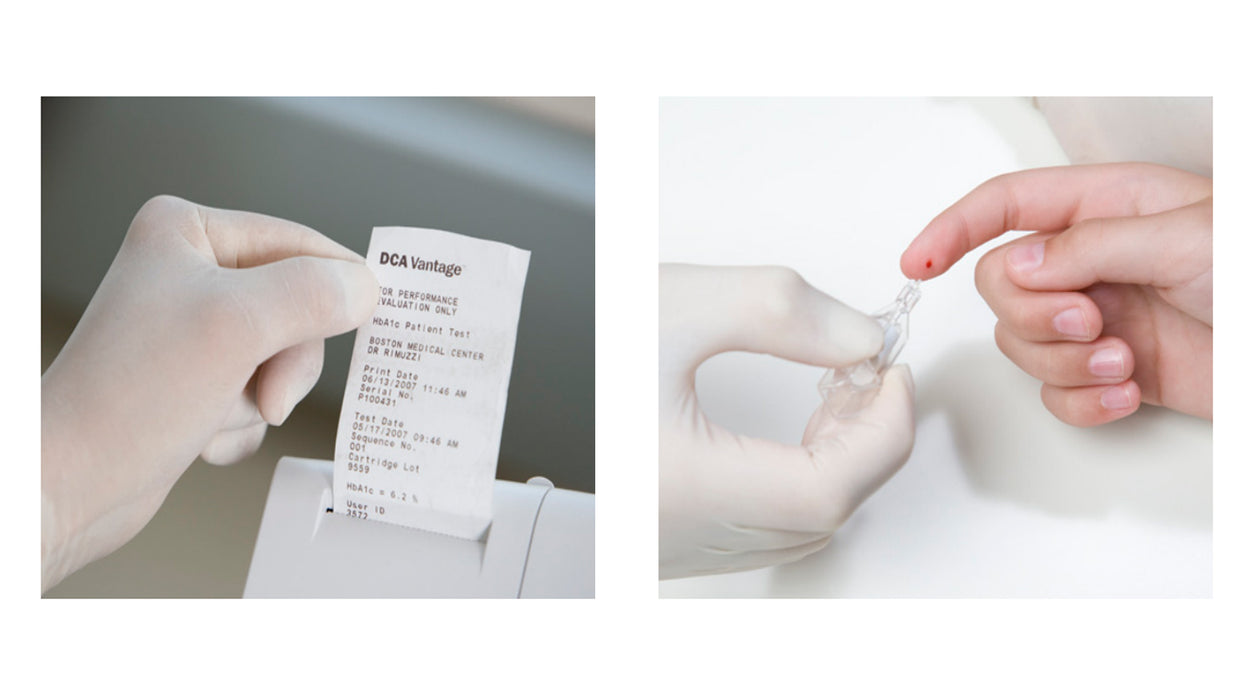 DCA Vantage Diabetes Analyzer