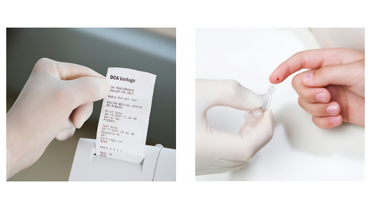 DCA Vantage Diabetes Analyzer