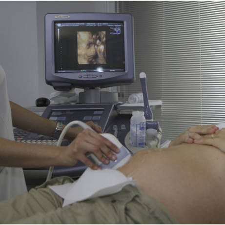 About Ultrasound Equipment