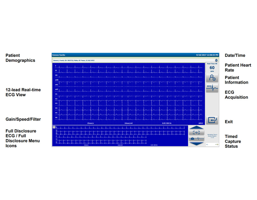Connex Cardio ECG