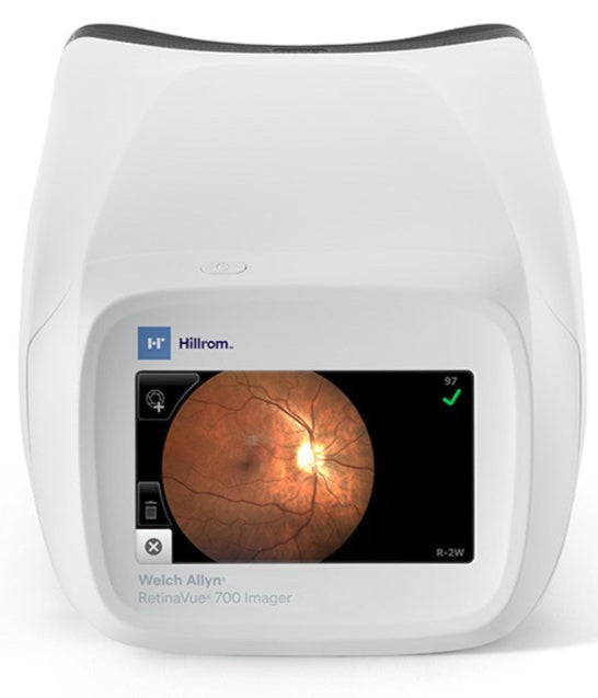 RetinaVue 700 Imager Handheld Retinal Vision Screener Camera