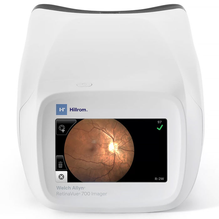Welch Allyn RetinaVue Handheld Vision Screener - Save at — Tiger Medical