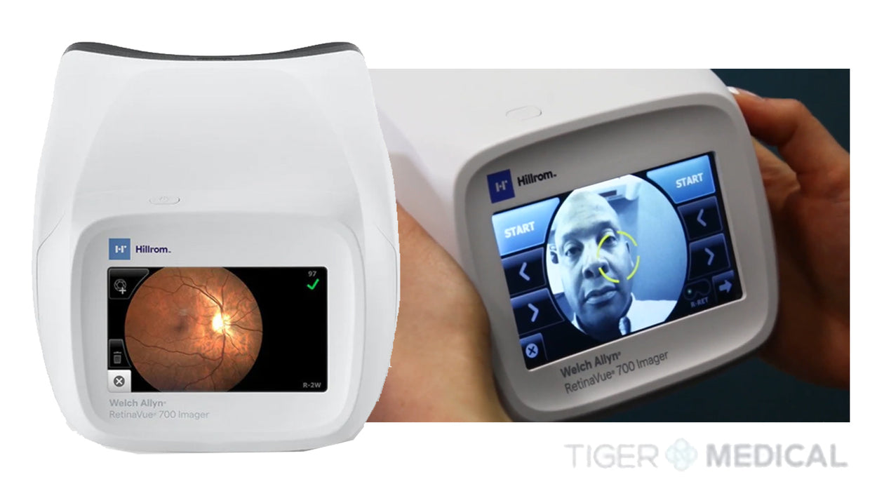 RetinaVue 700 Imager Handheld Retinal Vision Screener Camera