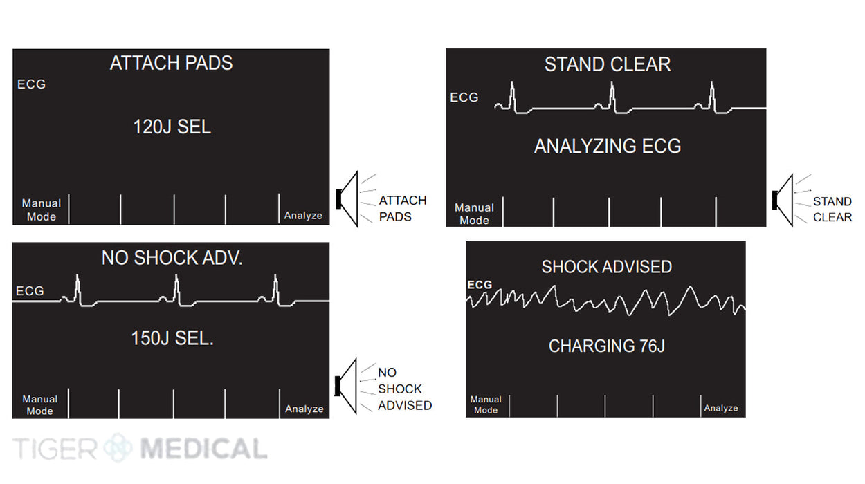 R-Series BLS Plus AED Defibrillator w/ One-Step Pacing Electrodes