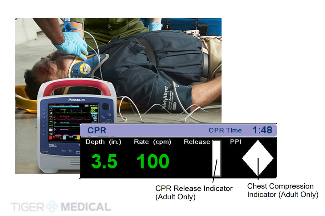Propaq MD Monitor/Defibrillator