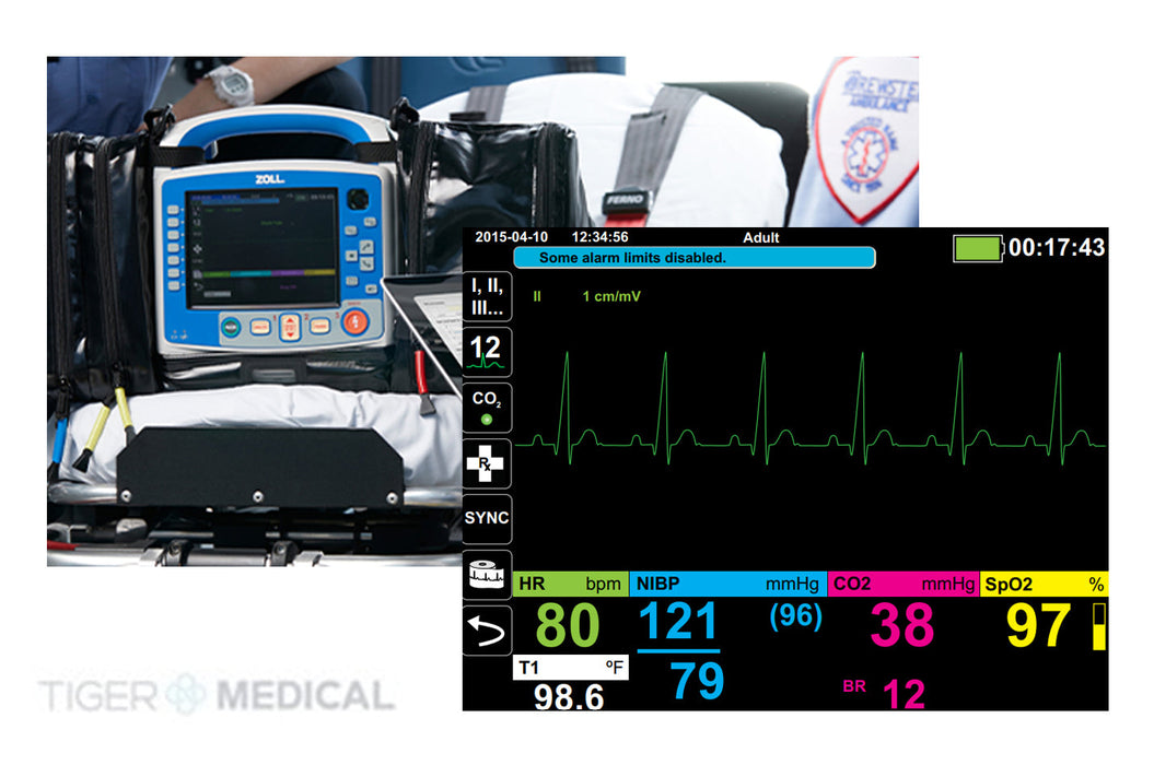 Advanced X Monitor/Defibrillator